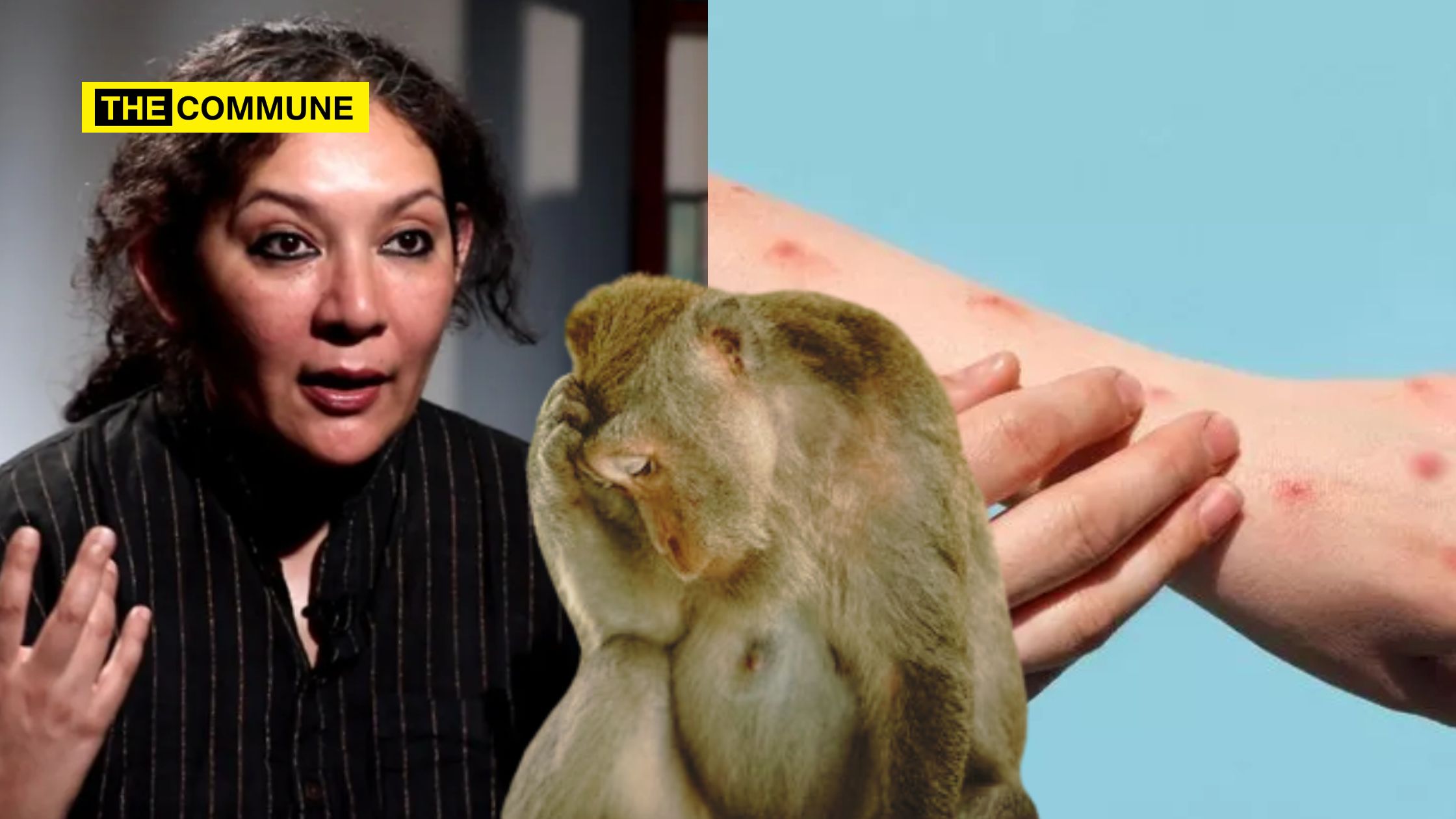 'Monkeypox Caused By Monkeys', Says Alleged Writer Saba Naqvi; Netizens