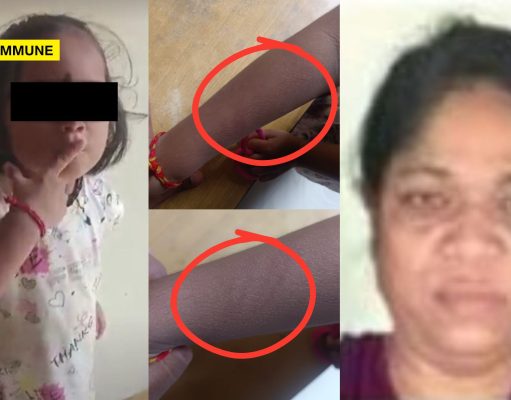 Chhattisgarh: NHRC Orders ₹50,000 Compensation To Nursery Girl Who Was Beaten By Christian Missionary-Run School Principal For Saying ‘Radhe Radhe’ mother teresa school principal arrested nursery girl radhe radhe