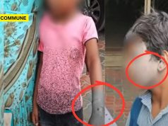 Stray Dog Menace: Two Schoolchildren Mauled By Stray Dogs In Separate Incidents In Madurai