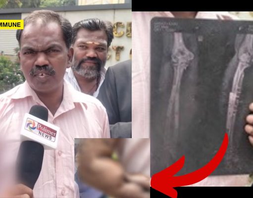 Man Alleges Medical Negligence At CBE Govt Hospital, Says Stapler Pin Left Inside Hand During Surgery Man Alleges Medical Negligence At CBE Govt Hospital, Claims Stapler Pin Left Inside Hand During Surgery