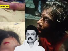 Dravidian Model: Intoxicated Gang Attacks 18-Yr-Old College Student With Machete In Minjur, Victim Critical Dravidian Model Intoxicated Gang Attacks 18-Yr-Old College Student With Machete In Minjur, Victim Critical